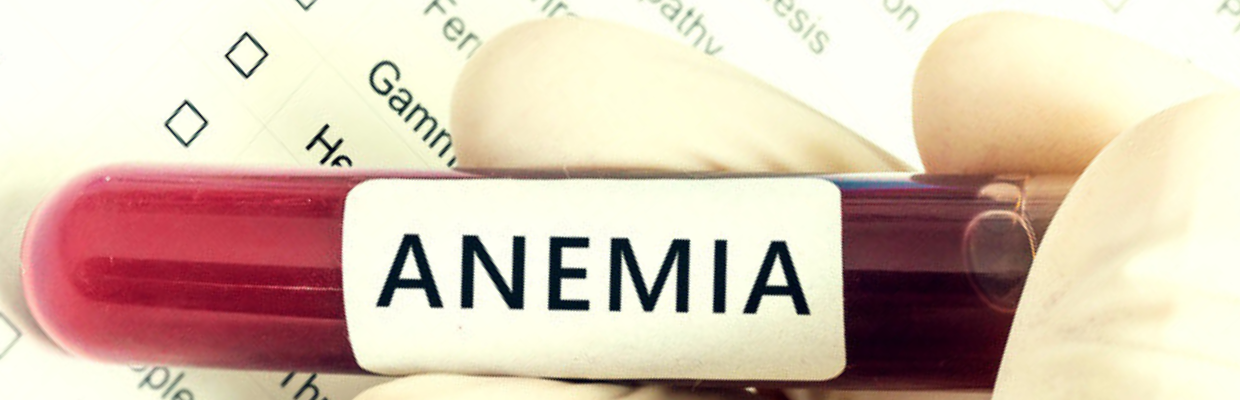 Anemia pernicioasa: simptome, cauze, optiuni de tratament