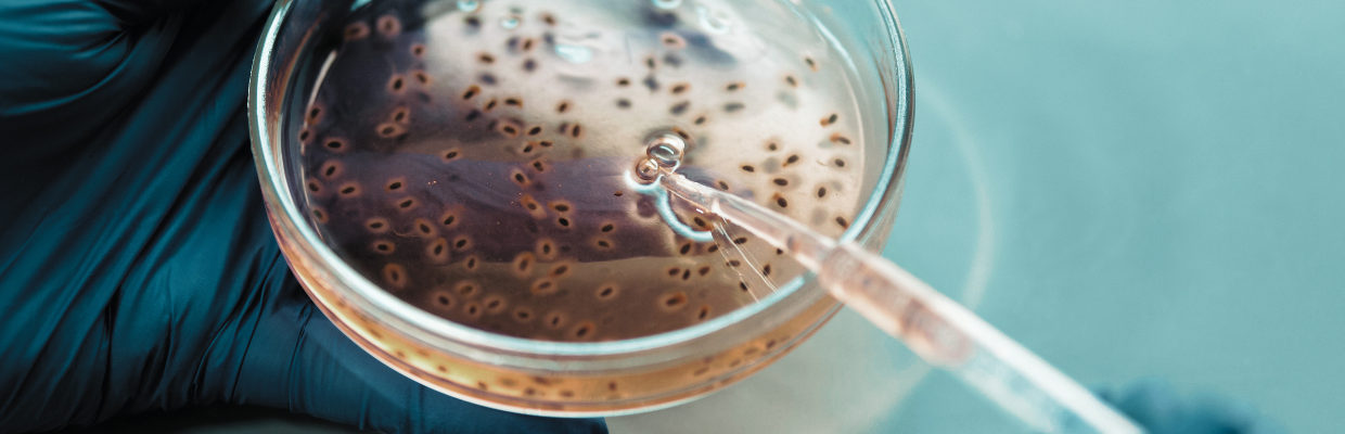 Cele mai periculoase bacterii pentru om: Ce boli produc, cum sa le evitam