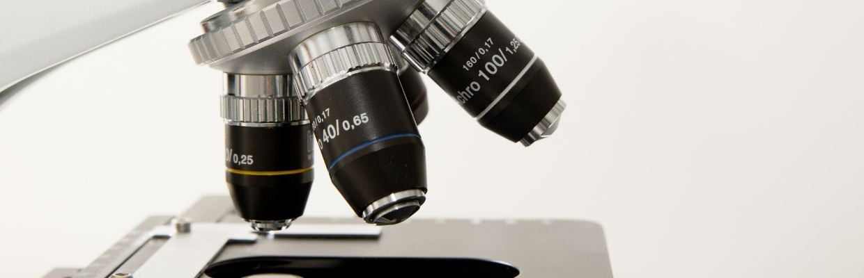 Anemia falciforma: o boala rara a sangelui care afecteaza persoanele non-caucaziene
