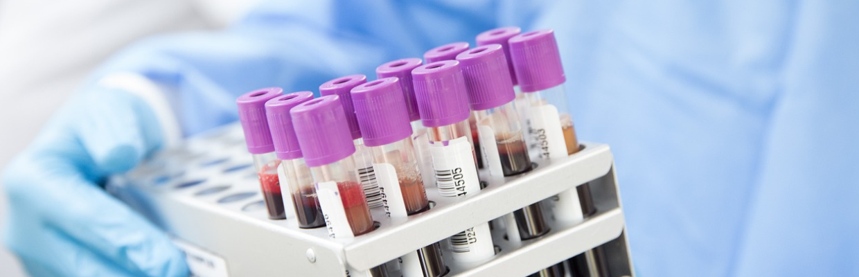 Calcitonina, un hormon implicat in reglarea metabolismului calciului. Ce trebuie sa retii
