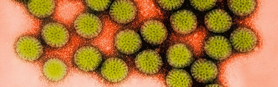 Glioblastom: diagnostic, complicatii ale bolii si optiuni de tratament