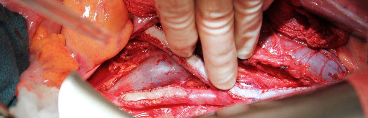 Carcinomul hepatocelular: De ce apare, cum se poate preveni, factori de risc