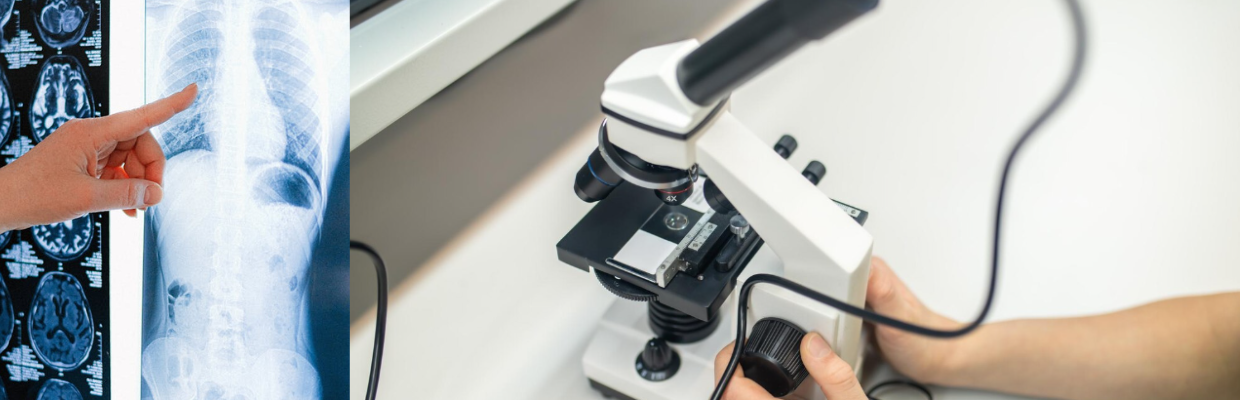 Gastroscopia: Ce este, cand este necesara, ce trebuie sa stim inainte