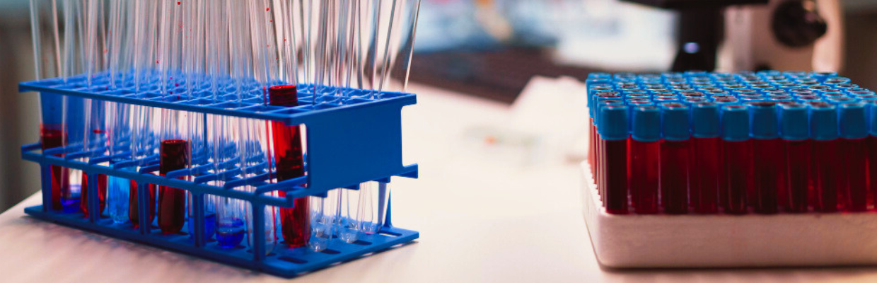 Proteina C Reactiva: Cum ajuta acest indicator, ce boli pot fi depistate cu proteina  C