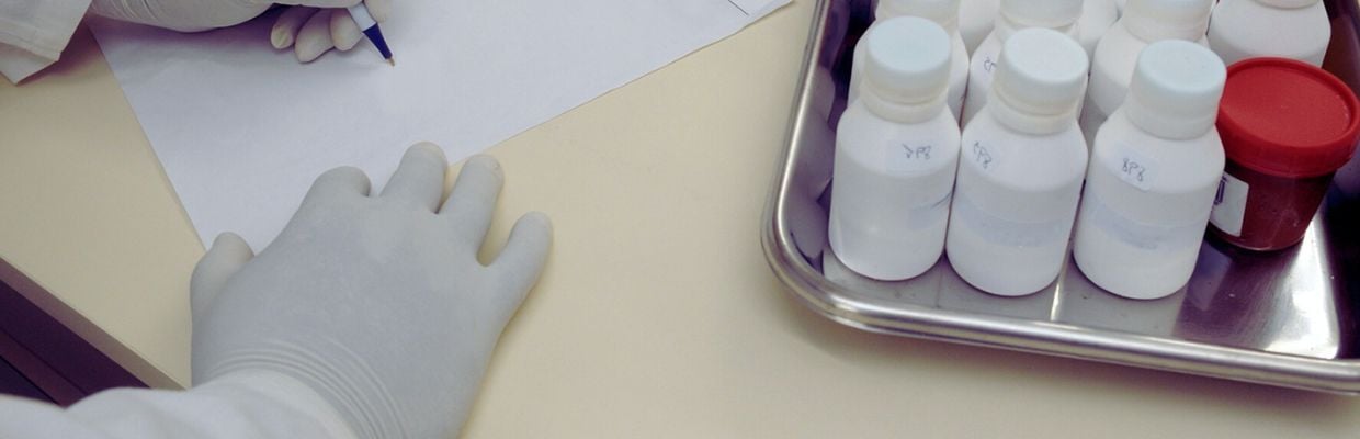 Testul anti-HCV: importanta depistarii hepatitei C, cum se face
