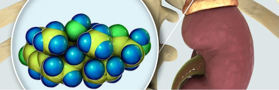 Diverticul Meckel: simptome, diagnostic si optiuni terapeutice