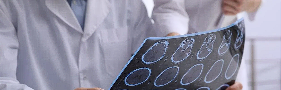 Encefalograma: Ce poti afla prin inregistrarea activitatii cerebrale