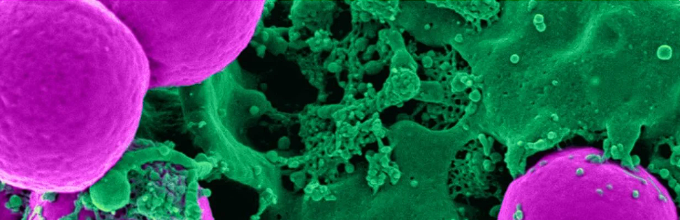 Fertilizarea in vitro: ce trebuie sa stii inainte de a apela la aceasta metoda