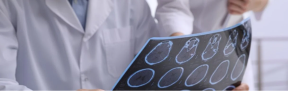 Afectiunile neurologice: Cum le putem identifica, clasificarea lor, tipuri de tratament