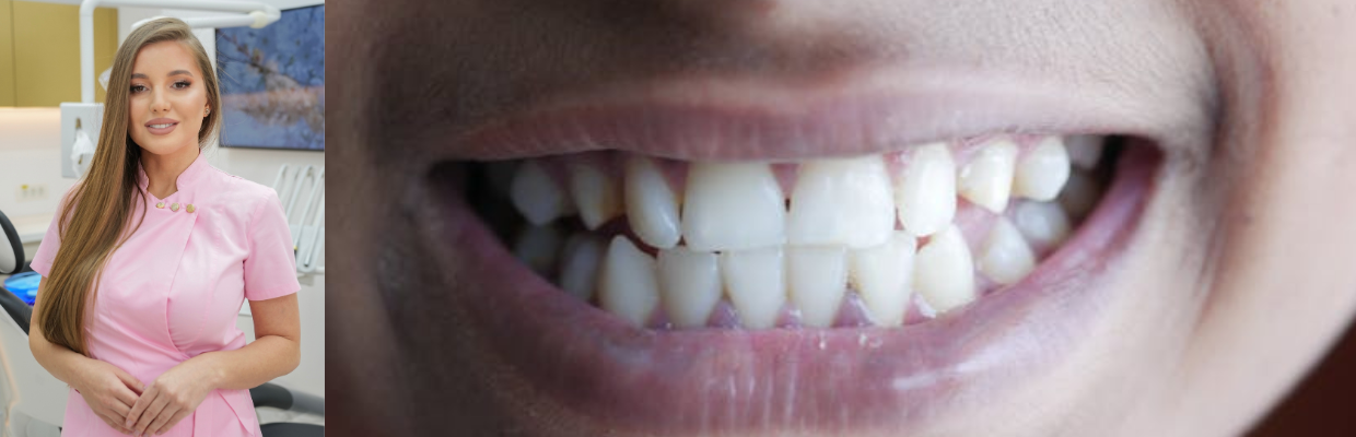 Dr. Alina Pripici: Legătura dintre stres, anxietate, bruxism și inflamația gingivală