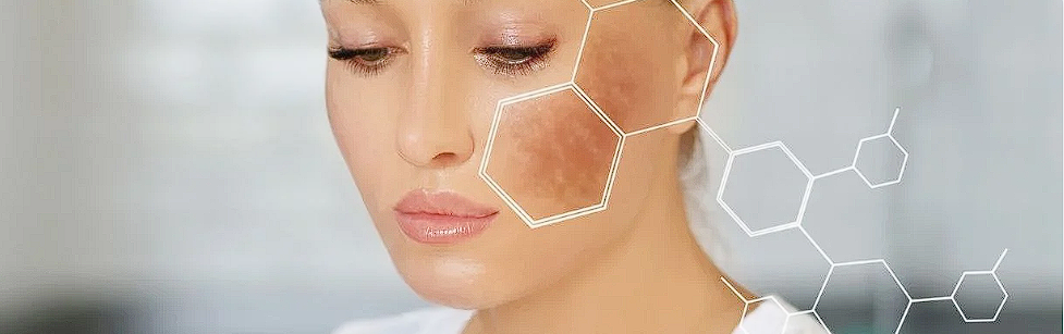 Dermatoscopia: Ce trebuie sa stim despre acest tip de investigatie