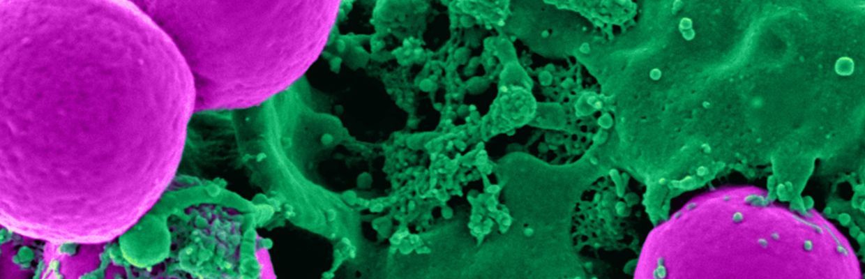 Sistemul digestiv: Beneficiile probioticelor pentru sanatatea organismului