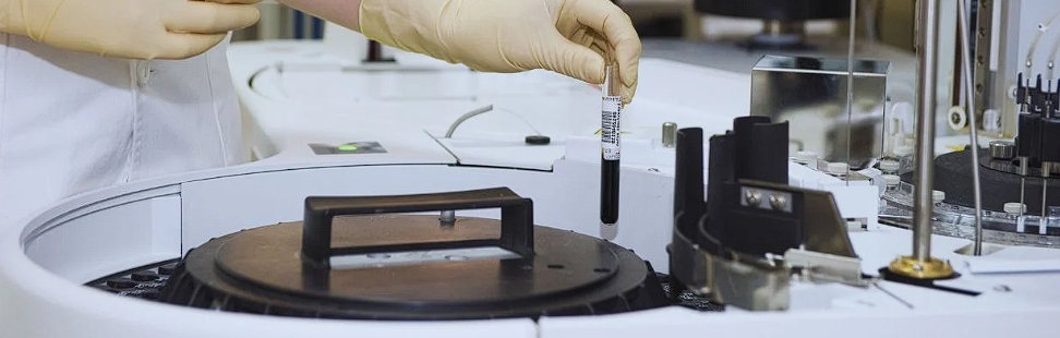 Scleroza amiotrofica laterala: Cum apare boala, simptome, tipuri de tratament