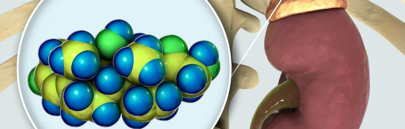 Boala Whipple: o afectiune rara care genereaza tulburari digestive. De ce apare