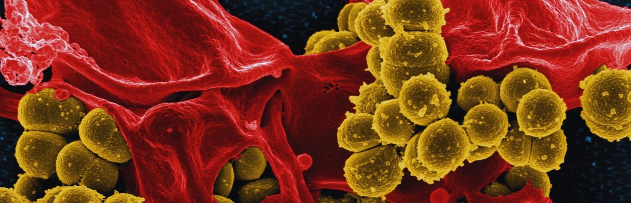 Feritina: Ce este, rolul sau in organism, importanta pentru sanatate