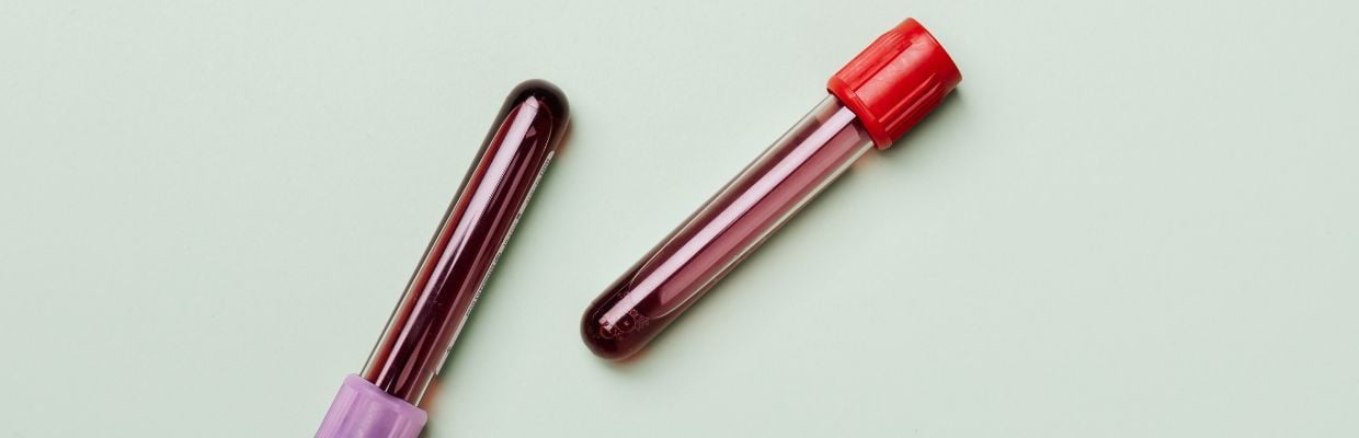 Grupele de sange si importanta lor. Cum afli grupa de sange