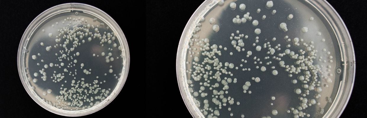 Listeria: ce este, cum puteti evita intoxicatia cu aceasta bacterie