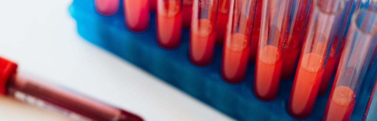 Hemofilia: Cum apare, preventie, simptome