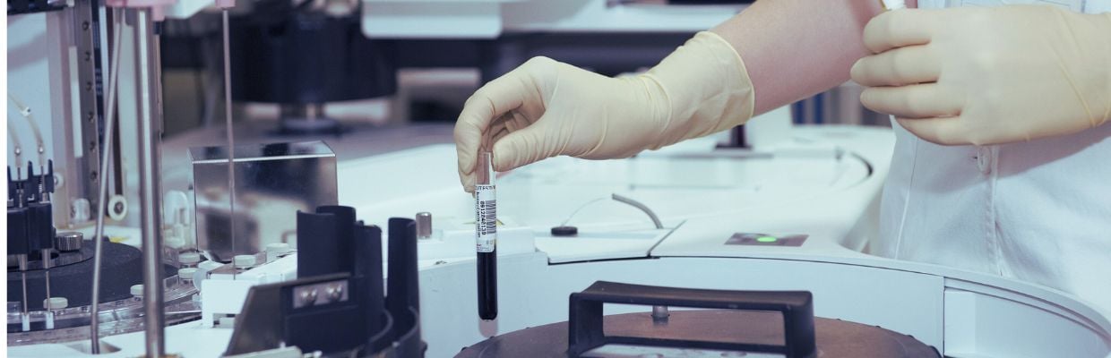 Hemograma: ce este, ce boli se pot depista cu ajutorul acestei investigatii