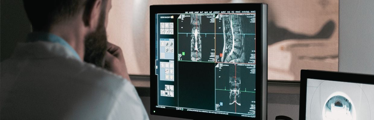 Boala Chédiak-Higashi: Diagnostic si optiuni de tratament