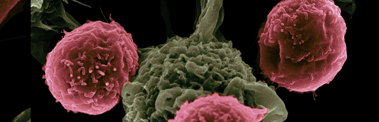 Neoplazia endocrina multipla (MEN): Cum recunosti afectiunea si cum se poate gestiona aceasta boala