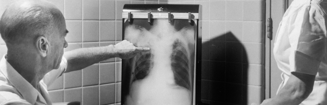 Pneumonia comunitara: cauze, simptome si tipuri de tratament tratament