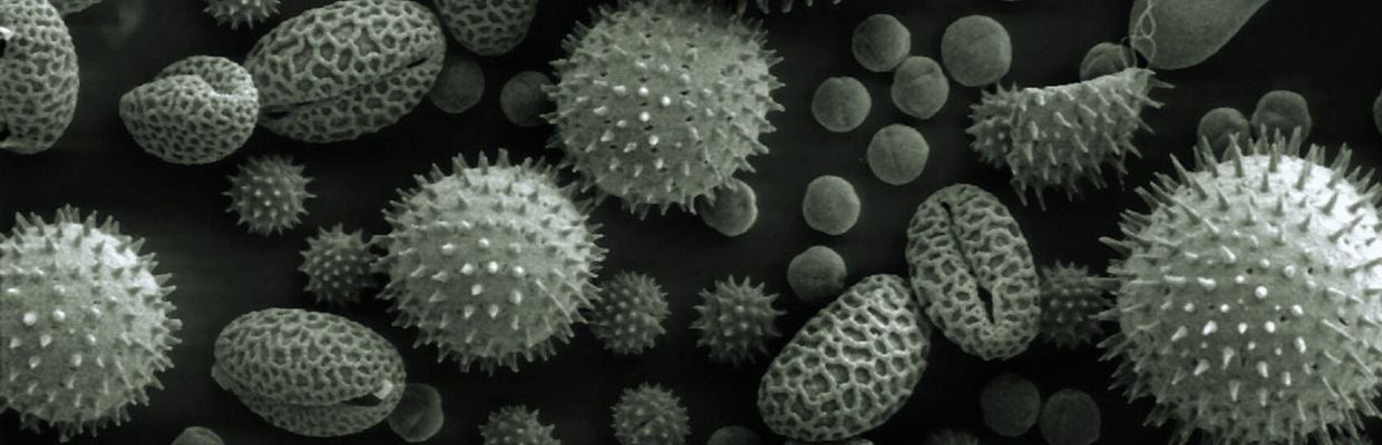 Toxoplasmoza: cauze, simptome si optiuni de tratament
