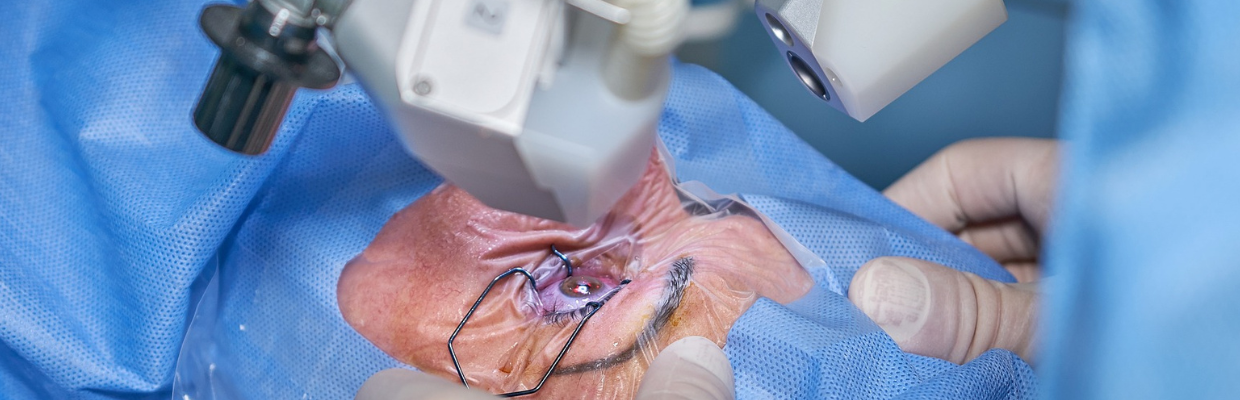 Implanturile zigomatice: ce sunt, cum se realizeaza si care sunt avantajele lor