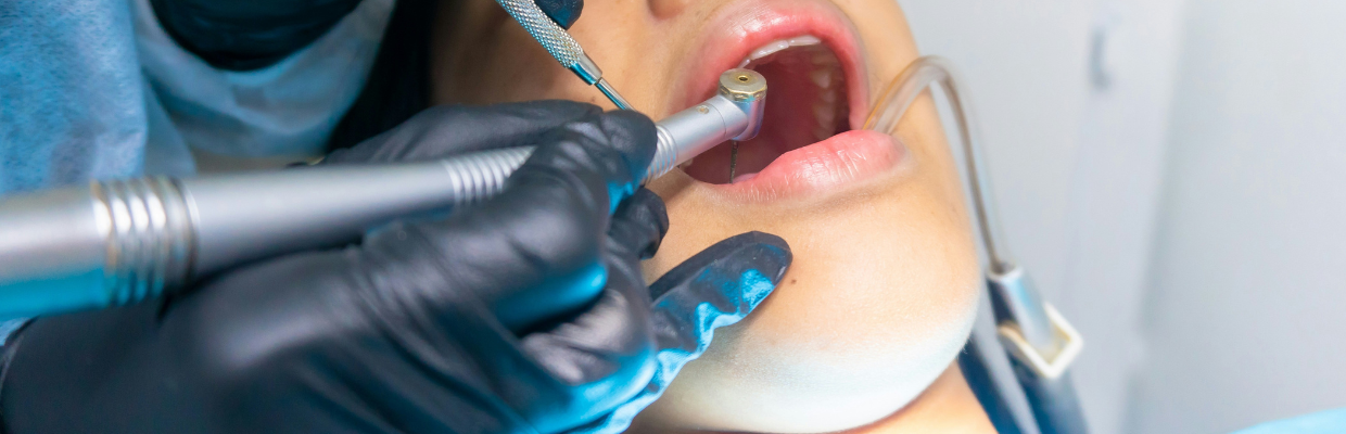 Prognatismul mandibular: de ce apare, cum se poate evita, tipuri de tratament