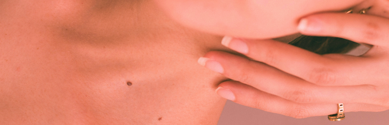 Purpura actinica: cauze, simptome si metode de preventie