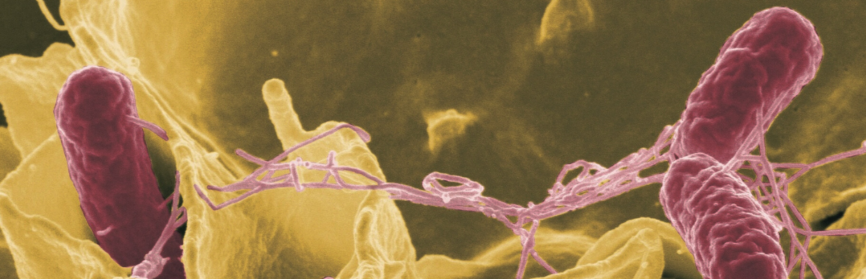Actinomicoza, o infectie care formeaza abcese si fistule: de ce apare si cum o putem evita