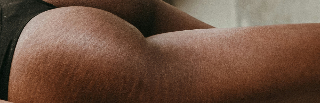 Sindromul pielii oparite: Cum recunosti aceasta afectiune dermatologica, optiuni de tratament
