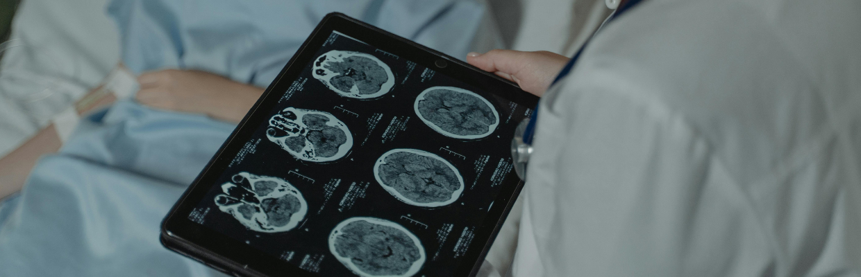 Craniofaringiomul: In ce conditii se formeaza aceasta tumoare rara, simptome, cum se poate gestiona afectiunea
