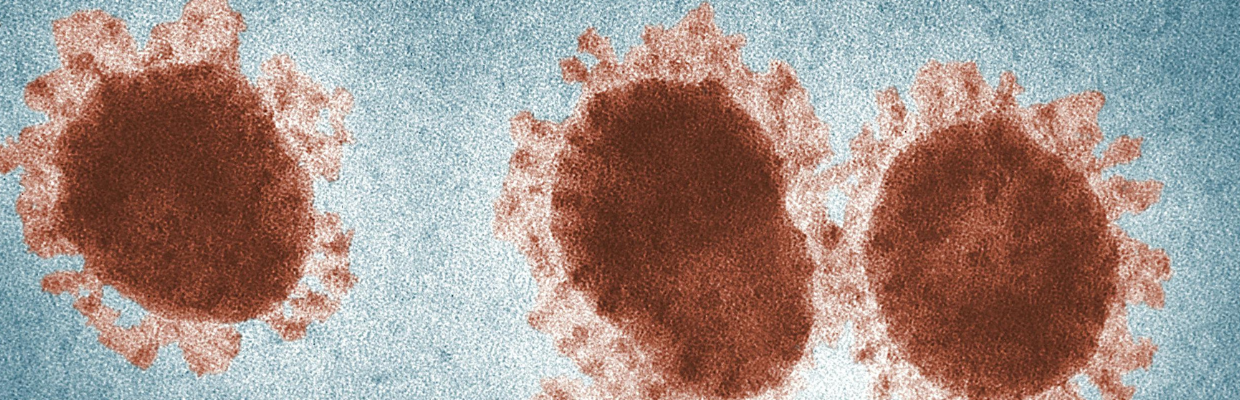 Chikungunya: Cum recunosti infectia cu acest virus, tipuri de tratament si preventie