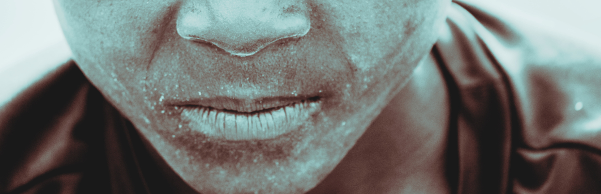 Dermatografia: Cum se instaleaza aceasta boala, tipuri de tratament si metode de preventie