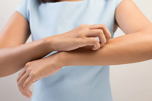 Dermatita de staza: cauze, forme, simptome, tratament