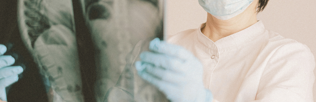 Adenomul hepatocelular: De ce apare, cum il recunosti, cum se poate preveni
