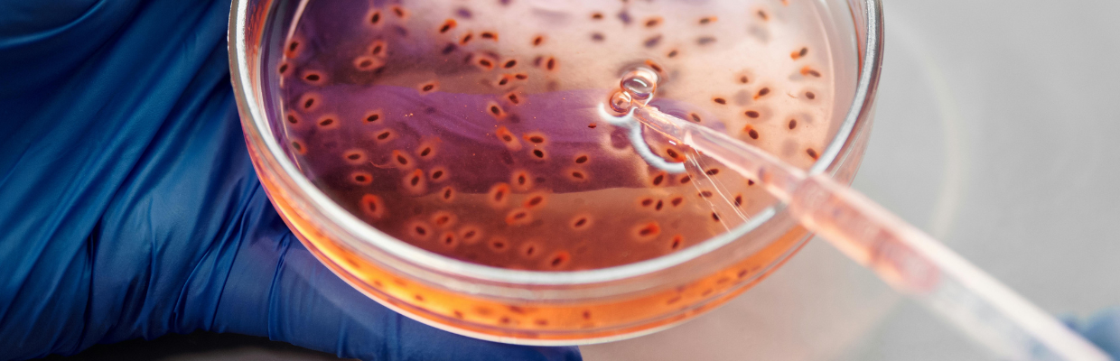 Boala polichistica hepatica: cauze, simptome ai optiuni de tratament