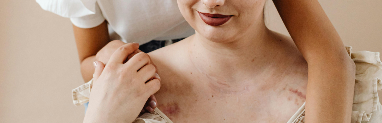 Epiteliomul bazocelular: Cum recunosti aceasta afectiune dermatologica, preventie si optiuni de tratament