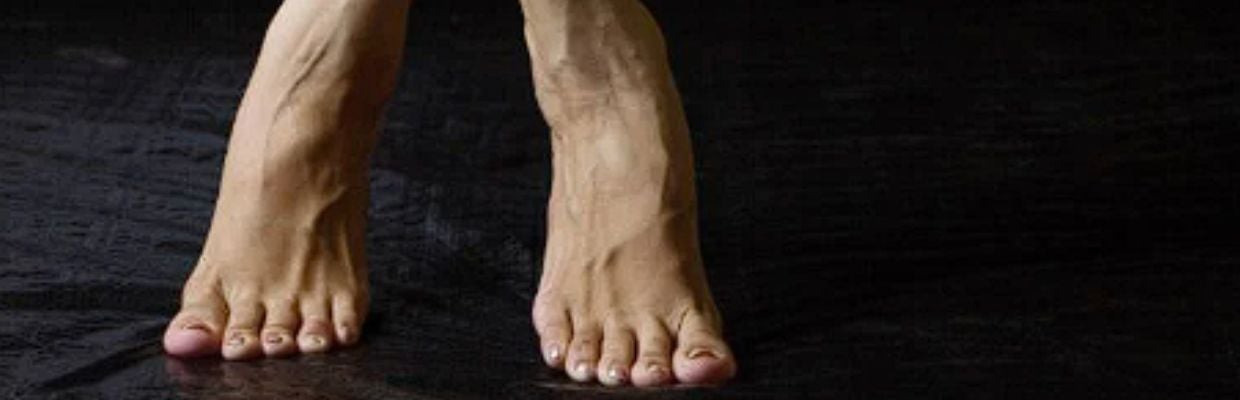 Tromboza: simptome, tipuri de tromboza si optiuni de tratament