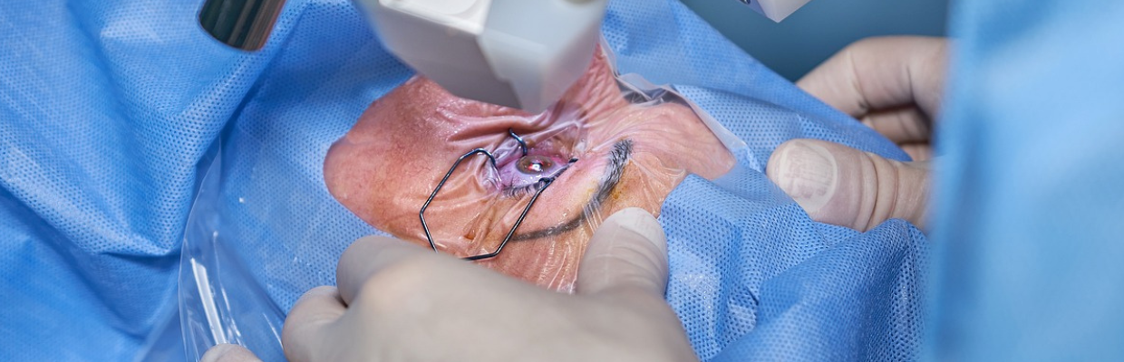 Transplant de cornee: Cand se recomanda si ce presupune inlocuirea corneei