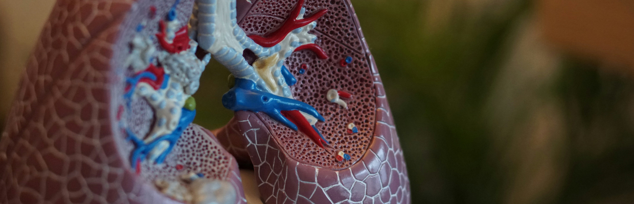 Edemul pulmonar: cauze, simptome si optiuni terapeutice