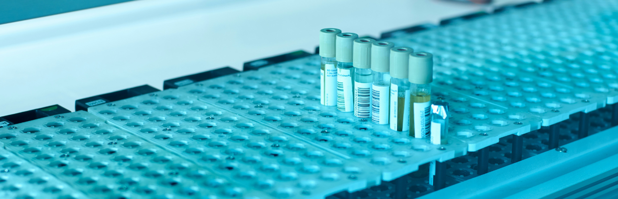 Siclemia: cauze, simptome, tipuri de tratament