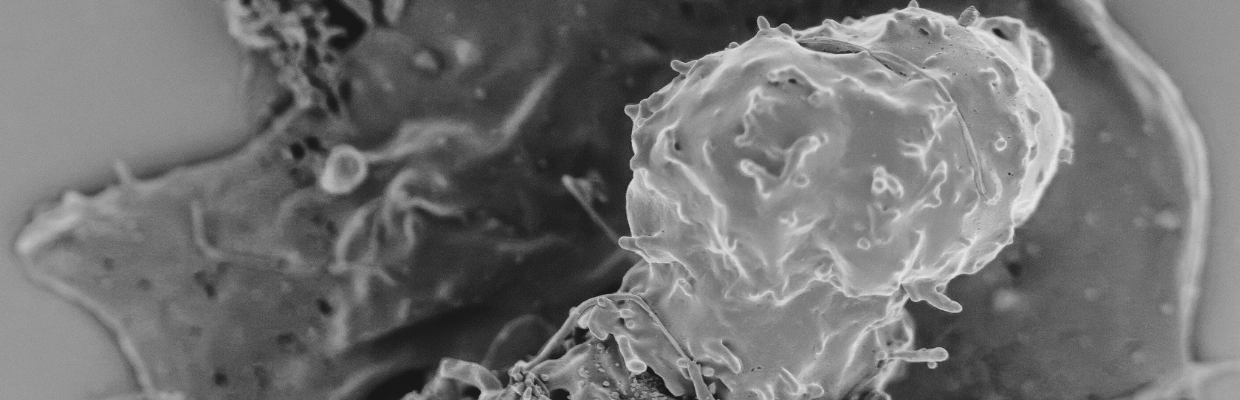 Monocite crescute: Ce sunt, importanta lor pentru organism, boli asociate cu acestea