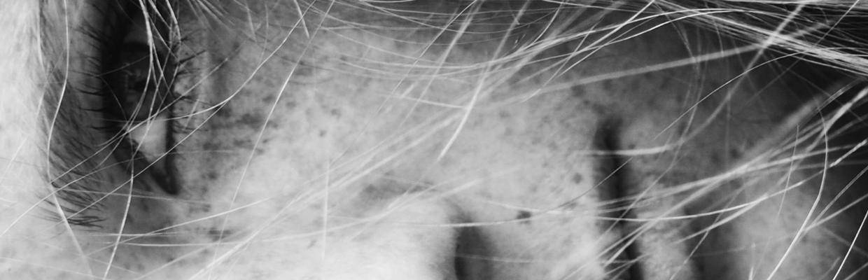 Verucile: De ce apar, cum se pot trata, metode de preventie