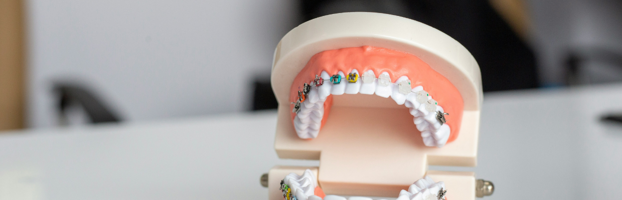 Replantarea dentara: Cand poate fi folosita pentru dintii avulsati, ce trebuie sa stim inainte de interventie