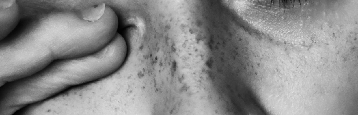 Abcesele cutanate: cauze, tratament si modalitati de preventie