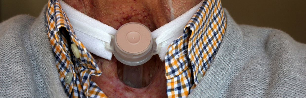 Cancerul de esofag: cauze, simptome, diagnostic, cum se poate gestiona