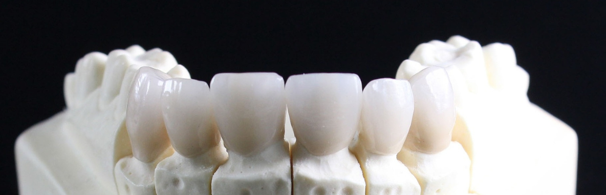 Gutiera dentara: ce rol are, cum se alege si cum se ingrijeste
