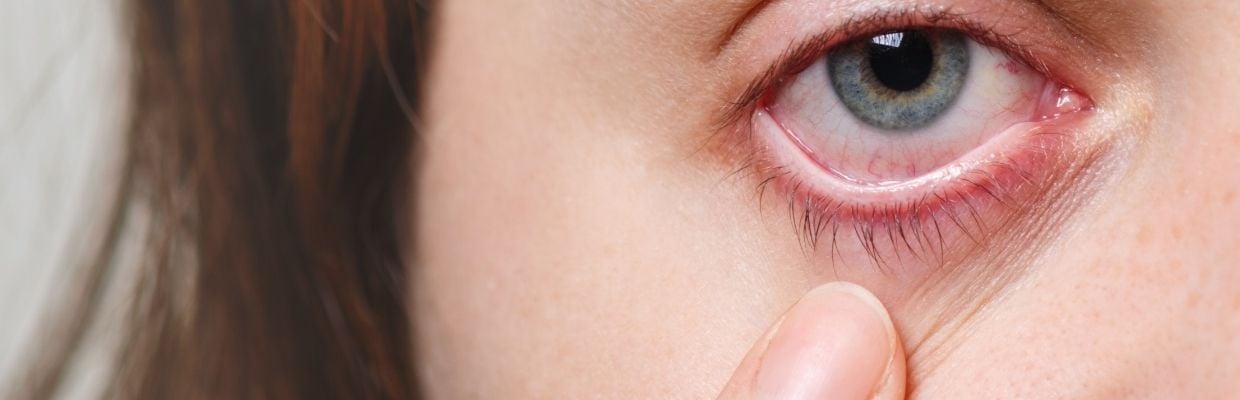Blefarita: Cum apare si cum se poate trata, moduri de preventie